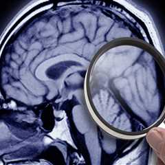 Study Suggests Obesity Can Spark Alzheimer’s Disease-Like Patterns In Brain