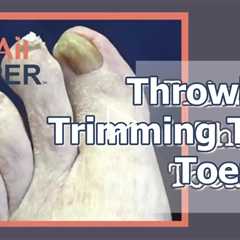 Throwback - Trimming Thick Toenails with Dr Nail Nipper