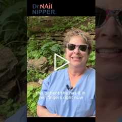 She Has Gout, But Not in Her Foot  #foothealth #drnailnipper #podiatrycare