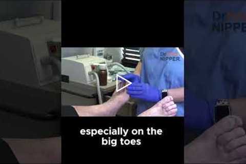 Why Regular Toenail Care Is Key to Comfort and Confidence! #ToenailCare #FootHealth #PodiatryTips
