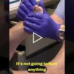 Discussion on Nail Care Techniques and Misconceptions ✂️