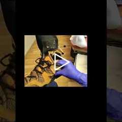 How to Properly Use and Maintain Your Brace for Maximum Support!