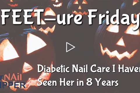 FEET-ure Friday | Really Thick Nails and a 8-year hiatus #thicktoenails