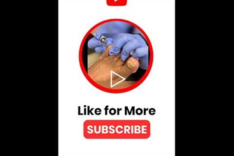 Health Tips for Happy Feet 🌟