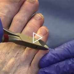 Why Toenails Should Be Cut Straight Across 👣✂️ | Dr Nail Nipper
