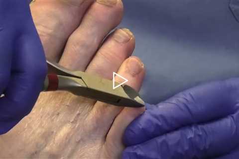 Why Toenails Should Be Cut Straight Across 👣✂️ | Dr Nail Nipper