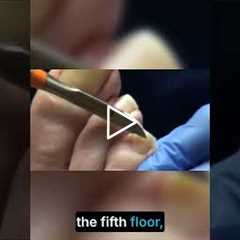 Take the Stairs: Small Changes for Big Health Gains!