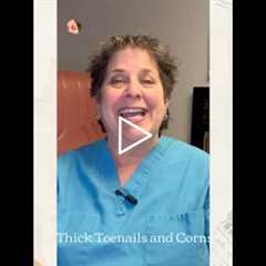 Thick Toenails and Corns | Hairdresser Returns — That Painful Corn Is MUCH Better! 👣✂️