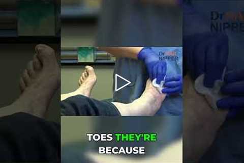 Are Arch Supports Really Necessary for Foot Pain? 👣