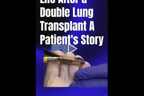 Life After a Double Lung Transplant A Patient's Story