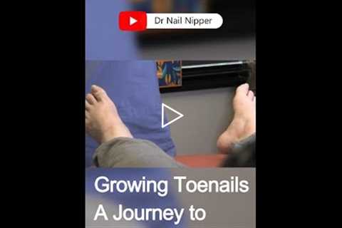 Dr. Nail Nipper Tackles Overgrown Toenails #pedicure #satisfying