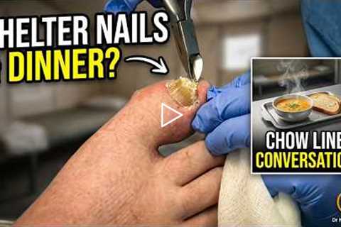 FEET-ure Friday | Nails and Dinner in the Shelter