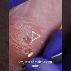 Walking with a stone in your shoe