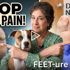 Friday FEET-ure | A Week of Calluses (Real Patients, Real Feet!)