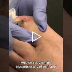 The Most Satisfying Foot Cleaning You’ll Ever See 👣✨