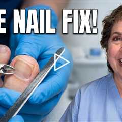 Two Toenail Cases Back-to-Back | The Unexpected Moment