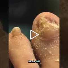 From Pre-Diabetic to Improving Fast: A1C Drops to 6.0!