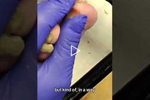 TSA agents and long lines