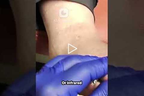 Neuropathy Clinics: Real Relief or Just a Scam? 🤔