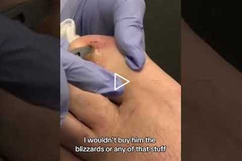 The Most Satisfying Foot Cleaning You’ll Ever See 👣✨