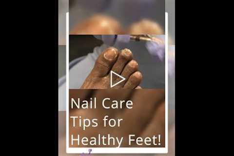 Cracked Heels & Thick Nails Smoothed Out | Instant Comfort | Nail Care Tips for Healthy Feet! 💅
