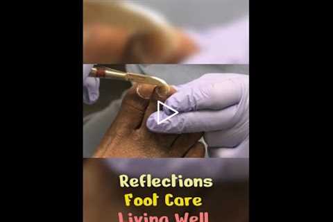 Reflections on Foot Care and Living Well 🌟