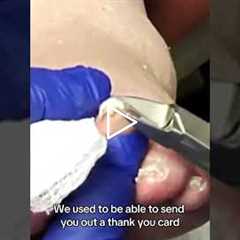 HIPAA regulations are making it impossible to thank patients for referrals