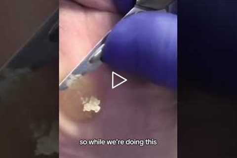 The Power of a Shout-out Connecting Patients