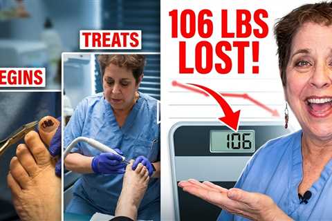 She Lost 106 Pounds in 4 Months 😳 | Diabetic Patient Transformation