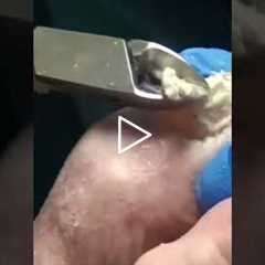 This Is What a Deep Foot Cleaning Looks Like