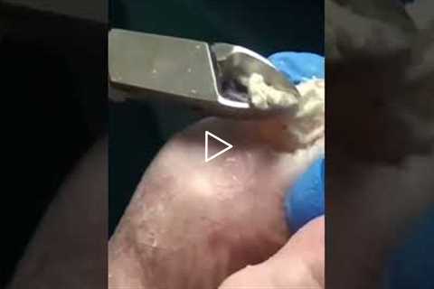 This Is What a Deep Foot Cleaning Looks Like