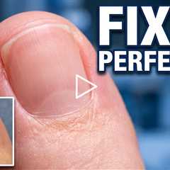 She Was Too Embarrassed to Show Her Feet... Until Now 🦶❤️ | Thick Toenails & Foot Care